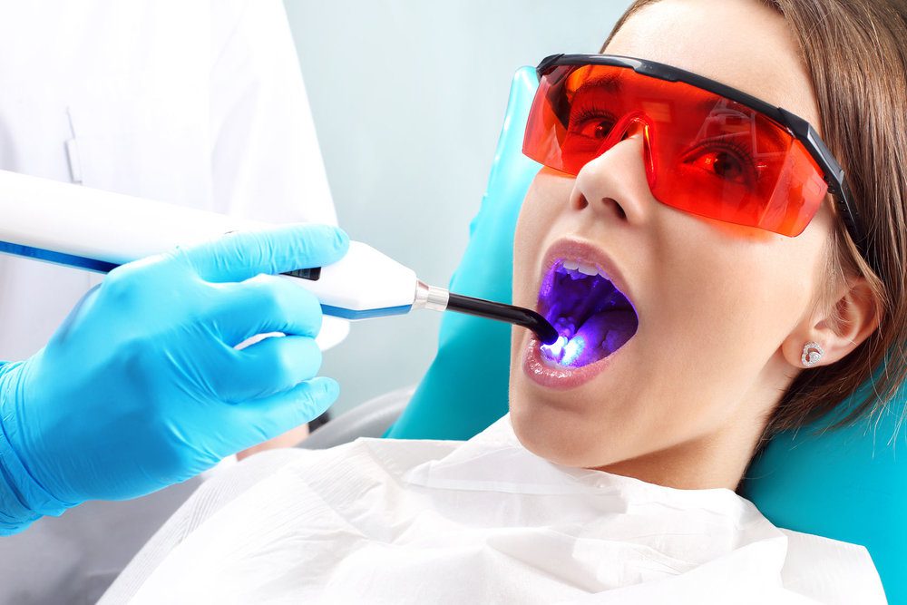 laser dentistry in Delhi